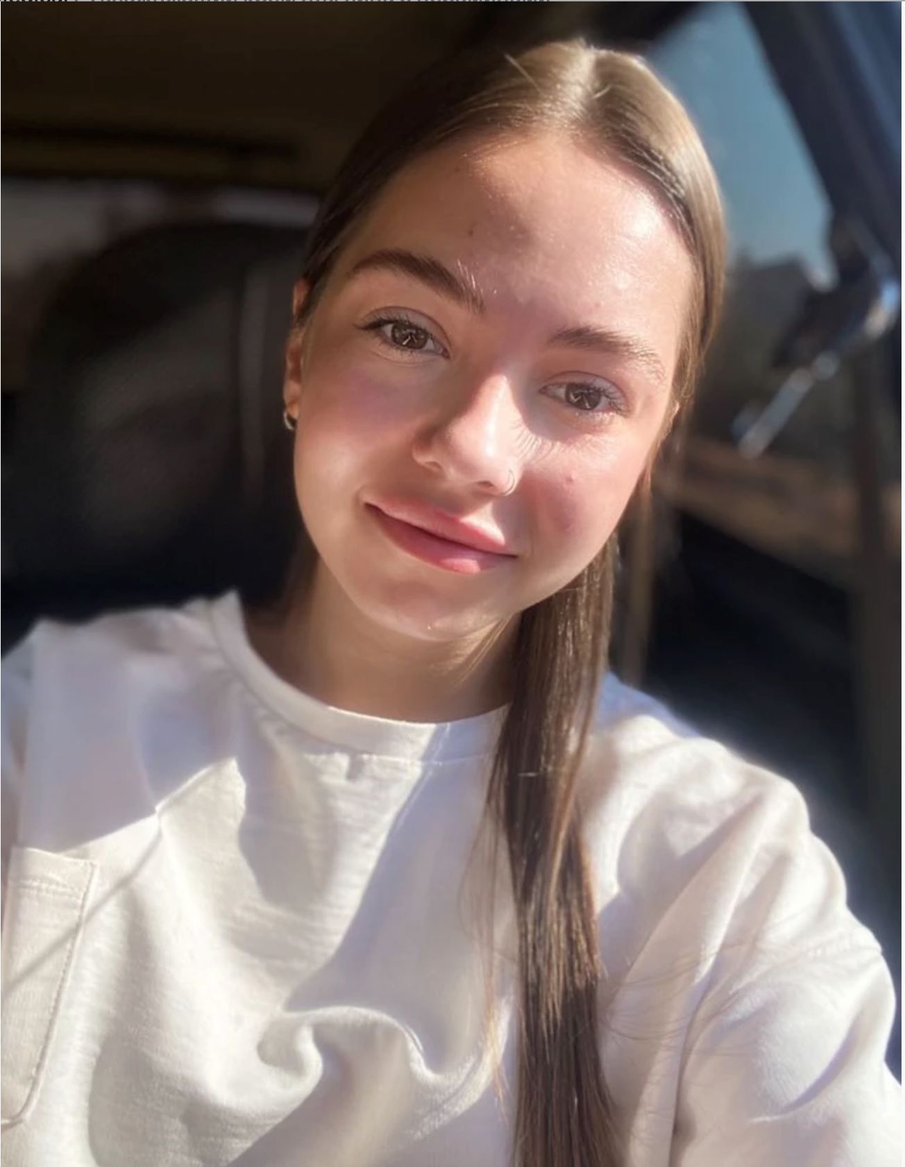 Результат ухода после